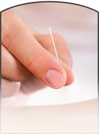 acupuncture